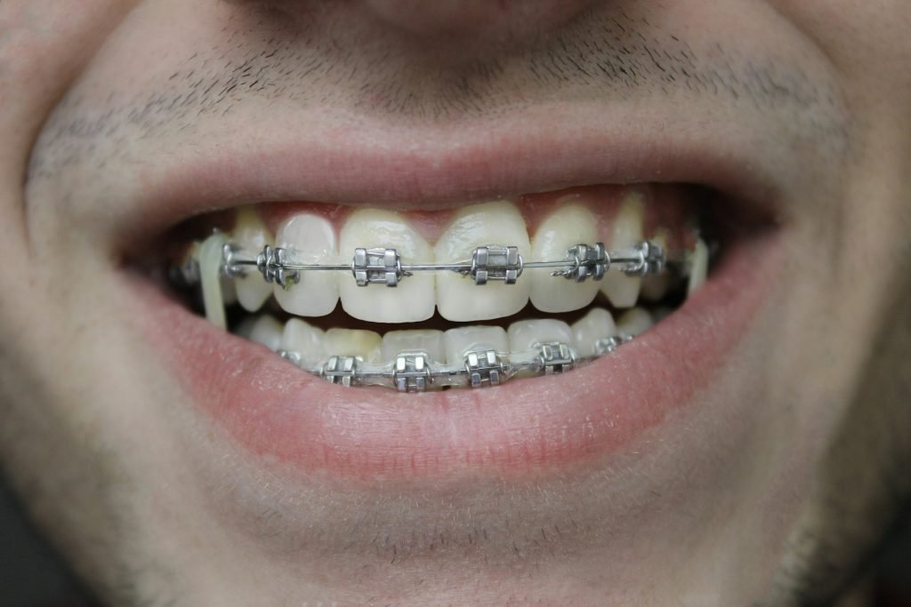 Close-up of a mouth and front teeth