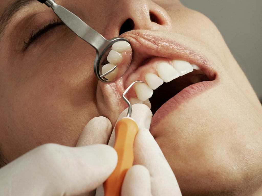 A dental examination using a mirror and probe